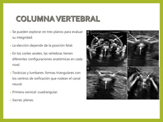 • Se pueden explorar en tres planos para evaluar
su integridad.
• La elección depende de la posición fetal.
• En los cortes axiales, las vértebras tienen
diferentes configuraciones anatómicas en cada
nivel.
• Torácicas y lumbares: formas triangulares con
los centros de osificación que rodean el canal
neural.
• Primera cervical: cuadrangular.
• Sacras: planas.
 