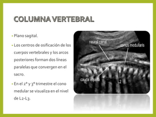 • Plano sagital.
• Los centros de osificación de los
cuerpos vertebrales y los arcos
posteriores forman dos líneas
paralelas que convergen en el
sacro.
• En el 2° y 3° trimestre el cono
medular se visualiza en el nivel
de L2-L3.
 