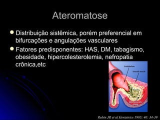 AteromatoseAteromatose
Distribuição sistêmica, porém preferencial emDistribuição sistêmica, porém preferencial em
bifurcações e angulações vascularesbifurcações e angulações vasculares
Fatores predisponentes: HAS, DM, tabagismo,Fatores predisponentes: HAS, DM, tabagismo,
obesidade, hipercolesterolemia, nefropatiaobesidade, hipercolesterolemia, nefropatia
crônica,etccrônica,etc
Rubin JR et al.Geriatrics 1985; 40: 34-39
 