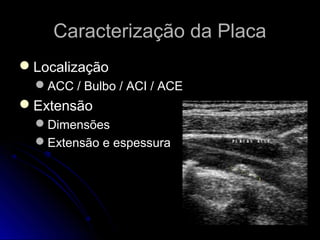 Caracterização da PlacaCaracterização da Placa
LocalizaçãoLocalização
ACC / Bulbo / ACI / ACEACC / Bulbo / ACI / ACE
ExtensãoExtensão
DimensõesDimensões
Extensão e espessuraExtensão e espessura
 