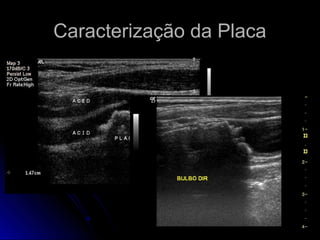 Caracterização da PlacaCaracterização da Placa
 