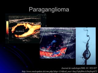 ParagangliomaParaganglioma
Journal de radiologie2000; 81: 953-957
http://www.med-update.de/cme.php?disp=114&sid_user=6ucj7efeifbho1t2hrj8sqi672
 