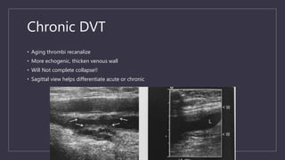 ultrasound DVT PHUDIT | PPT