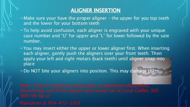 invisalign