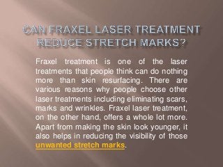 Fraxel treatment is one of the laser
treatments that people think can do nothing
more than skin resurfacing. There are
various reasons why people choose other
laser treatments including eliminating scars,
marks and wrinkles. Fraxel laser treatment,
on the other hand, offers a whole lot more.
Apart from making the skin look younger, it
also helps in reducing the visibility of those
unwanted stretch marks.
 