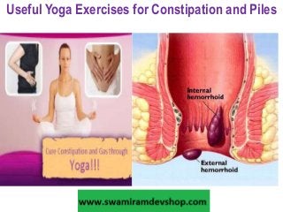 Useful Yoga Exercises for Constipation and Piles 
 