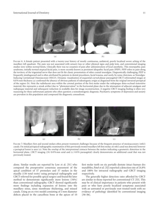 Use of cone beam computed tomography in endodontics | PDF