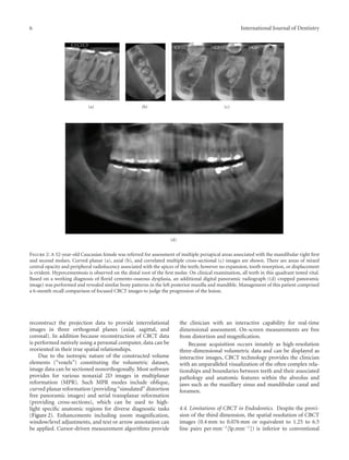 Use of cone beam computed tomography in endodontics | PDF