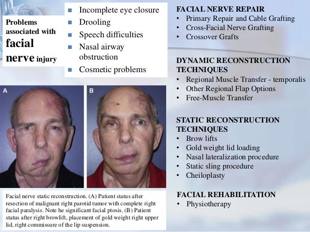 Repair of muscle facial trauma