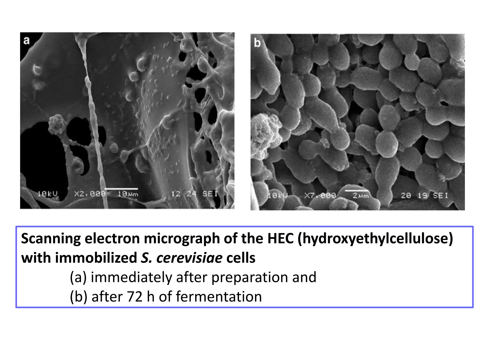Scanning electron micrograph of the HEC (hydroxyethylcellulose)
with immobilized S. cerevisiae cells
(a) immediately after preparation and
(b) after 72 h of fermentation
 