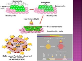 Use of Nanotechnology in Diagnosis and Treatment of Cancer | PPTX