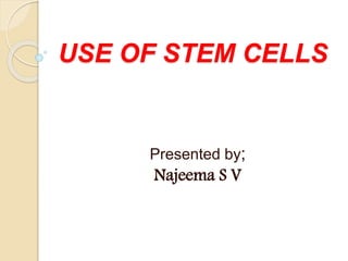 USE OF STEM CELLS
Presented by;
Najeema S V
 