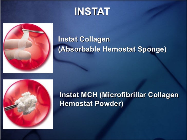 Use Of Tissue Sealants And Hemostatic Agents