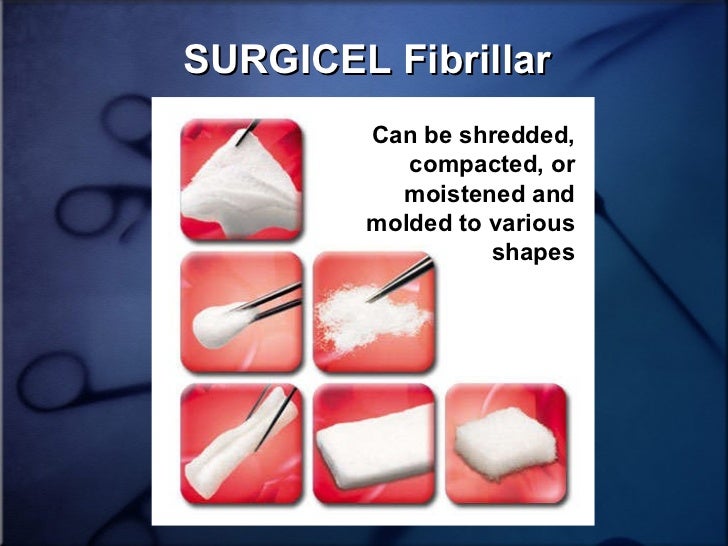 Use Of Tissue Sealants And Hemostatic Agents