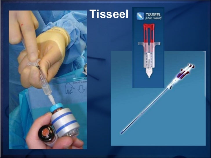 Use Of Tissue Sealants And Hemostatic Agents