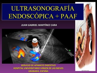 ULTRASONOGRAFÍA ENDOSCÓPICA + PAAF SERVICIO DE APARATO DIGESTIVO HOSPITAL UNIVERSITARIO VIRGEN DE LAS NIEVES GRANADA. ESPAÑA JUAN GABRIEL MARTÍNEZ CARA 
