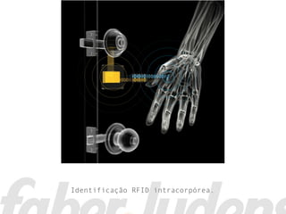Identificação RFID intracorpórea.
 