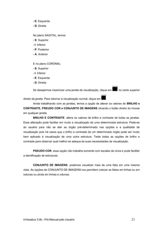 - E: Esquerda
        - D: Direita


        No plano SAGITAL, temos:
        - S: Superior
        - I: Inferior
        - P: Posterior
        - A: Anterior


        E no plano CORONAL:
        - S: Superior
        - I: Inferior
        - E: Esquerda
        - D: Direita

        Se desejarmos maximizar uma janela de visualização, clique em      no canto superior


direito da janela. Para retornar à visualização normal, clique em   .
        Ainda trabalhando com as janelas, temos a opção de alterar os valores de BRILHO e
CONTRASTE, PSEUDO COR e CONJUNTO DE IMAGENS clicando o botão direito do mouse
em qualquer janela.
        BRILHO E CONTRASTE: altera os valores de brilho e contraste de todas as janelas.
Essa alteração pode facilitar em muito a visualização de uma determinada estrutura. Pede-se
ao usuário para não se ater ao órgão pré-determinado nas opções e a qualidade de
visualização pois há casos que o brilho e contraste de um determinado órgão pode ser muito
bem aplicado à visualização de uma outra estrutura. Teste todas as opções de brilho e
contraste para observar qual melhor se adequa às suas necessidades de visualização.


        PSEUDO COR: essa opção não trabalha somente com escalas de cinza e pode facilitar
a identificação de estruturas.


        CONJUNTO DE IMAGENS: podemos visualizar mais de uma fatia em uma mesma
vista. As opções de CONJUNTO DE IMAGENS nos permitem colocar as fatias em linhas ou em
colunas ou ainda em linhas e colunas.




InVesalius 3.0b - Pré Manual pelo Usuário                                             21
 