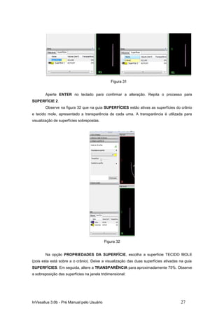 Figura 31


       Aperte ENTER no teclado para confirmar a alteração. Repita o processo para
SUPERFÍCIE 2.
       Observe na figura 32 que na guia SUPERFÍCIES estão ativas as superfícies do crânio
e tecido mole, apresentado a transparência de cada uma. A transparência é utilizada para
visualização de superfícies sobrepostas.




                                            Figura 32


       Na opção PROPRIEDADES DA SUPERFÍCIE, escolha a superfície TECIDO MOLE
(pois esta está sobre a o crânio). Deixe a visualização das duas superfícies ativadas na guia
SUPERFÍCIES. Em seguida, altere a TRANSPARÊNCIA para aproximadamente 75%. Observe
a sobreposição das superfícies na janela tridimensional:




InVesalius 3.0b - Pré Manual pelo Usuário                                             27
 