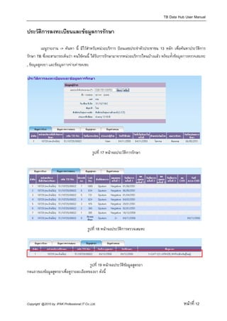TB Data Hub User Manual

ประวัติการลงทะเบียนและขอมูลการรักษา

        เมนูรายงาน -> คนหา นี้ มีไวสําหรับหนวยบริการ ปอนเลขประจําตัวประชาชน 13 หลัก เพื่อคนหาประวัติการ
รักษา TB ซึ่งจะสามารถเห็นวา คนไขคนนี้ ไดรับการรักษามาจากหนวยบริการไหนบางแลว  พรอมทั้งขอมูลการตรวจเสมหะ
, ขอมูลสูตรยา และขอมูลการจายคาชดเชย
 




                                                                                                              

                                             รูปที่ 17 หนาจอประวัติการรักษา
          
 




                                                                                                              

                                          รูปที่ 18 หนาจอประวัติการตรวจเสมหะ
 



                                                                                                              

                                      รูปที่ 19 หนาจอประวัติขอมูลสูตรยา
กดแถวของขอมูลสูตรยาเพื่อดูรายละเอียดของยา ดังนี้




Copyright @2010 by IPAK Professional IT Co.,Ltd.                                                หนาที่ 12
 