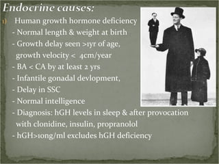 Human growth hormone deficiency - Normal length & weight at birth - Growth delay seen >1yr of age, growth velocity <  4cm/year - BA < CA by at least 2 yrs - Infantile gonadal devlopment, - Delay in SSC - Normal intelligence - Diagnosis: hGH levels in sleep & after provocation with clonidine, insulin, propranolol - hGH>10ng/ml excludes hGH deficiency 