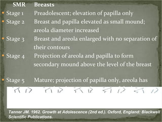 SMR Breasts Stage 1 Preadolescent; elevation of papilla only Stage 2 Breast and papilla elevated as small mound; areola diameter increased Stage 3 Breast and areola enlarged with no separation of their contours Stage 4 Projection of areola and papilla to form secondary mound above the level of the breast Stage 5 Mature; projection of papilla only, areola has recessed to the general contour of the breast Tanner JM. 1962. Growth at Adolescence (2nd ed.). Oxford, England: Blackwell Scientific Publications.  