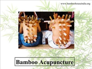 Bamboo Acupuncture www.bamboohouseindia.org 