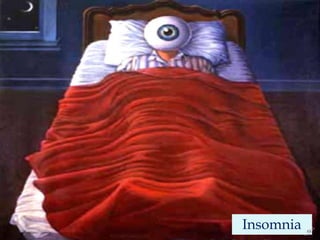   Insomnia