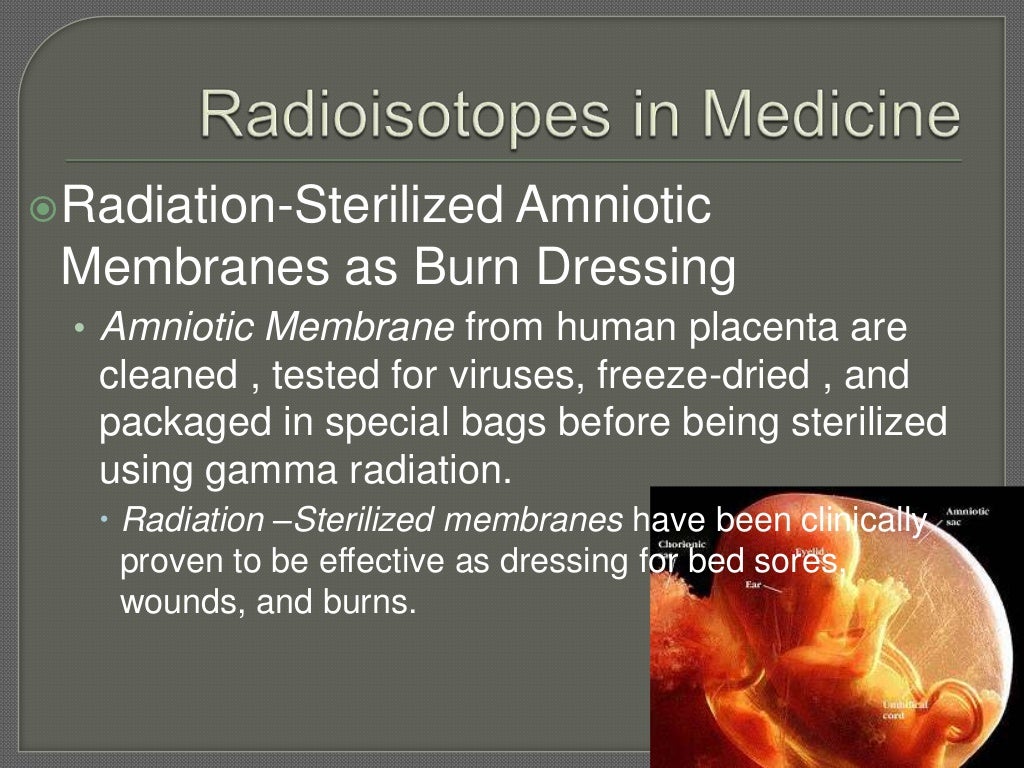 Uses of radioisotopes