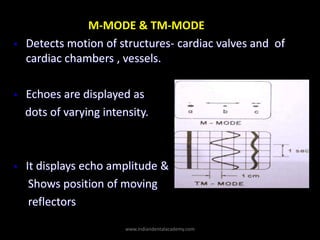 M-MODE & TM-MODE
• Detects motion of structures- cardiac valves and of
cardiac chambers , vessels.
• Echoes are displayed ...