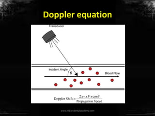 Doppler equation
www.indiandentalacademy.com
 