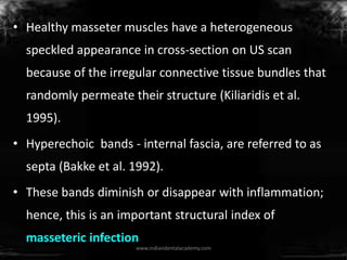 • Healthy masseter muscles have a heterogeneous
speckled appearance in cross-section on US scan
because of the irregular c...