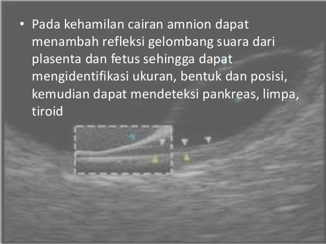 Persiapan Pemeriksaan USG Ultrasonografi