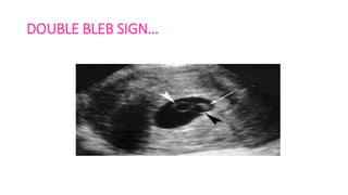 Ultrasound and usg doppler in obstetrics | PPTX