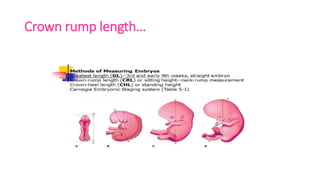 Ultrasound and usg doppler in obstetrics | PPTX