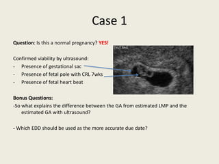 Case 1
Question: Is this a normal pregnancy? YES!
Confirmed viability by ultrasound:
- Presence of gestational sac
- Presence of fetal pole with CRL 7wks
- Presence of fetal heart beat
Bonus Questions:
-So what explains the difference between the GA from estimated LMP and the
estimated GA with ultrasound?
- Which EDD should be used as the more accurate due date?
 