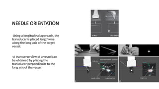 NEEDLE ORIENTATION
-Using a longitudinal approach, the
transducer is placed lengthwise
along the long axis of the target
vessel.
-A transverse view of a vessel can
be obtained by placing the
transducer perpendicular to the
long axis of the vessel
 