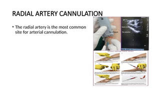 RADIAL ARTERY CANNULATION
• The radial artery is the most common
site for arterial cannulation.
 