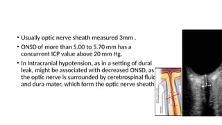 • Usually optic nerve sheath measured 3mm .
• ONSD of more than 5.00 to 5.70 mm has a
concurrent ICP value above 20 mm Hg.
• In Intracranial hypotension, as in a setting of dural
leak, might be associated with decreased ONSD, as
the optic nerve is surrounded by cerebrospinal fluid
and dura mater, which form the optic nerve sheath.
 