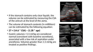 • If the stomach contains only clear liquids, the
volume can be estimated by measuring the CSA
of the antrum at the level of the aorta.
• The volume of stomach contents (in milliliters)
can be estimated by the following equation:
• 27 + (14.6 * CSA) – (1.28 * age)
• Gastric volumes <1.5 ml/kg are considered
normal (consistent with baseline secretions),
associated with a low risk of aspiration under
anesthesia. Volumes greater than 1.5 ml/kg are
treated as positive findings.
 