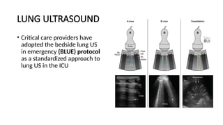 LUNG ULTRASOUND
• Critical care providers have
adopted the bedside lung US
in emergency (BLUE) protocol
as a standardized approach to
lung US in the ICU
 