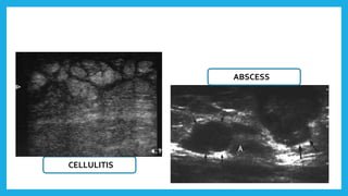 Ultrasonography - Head and Neck applications | PPTX