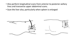 Ultrasound Normal Anatomy of Major Organs | PPTX