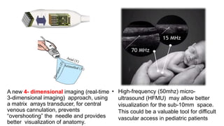 Usg applications in anaesthesia dr gs | PPTX