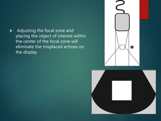  Adjusting the focal zone and
placing the object of interest within
the center of the focal zone will
eliminate the misplaced echoes on
the display
 