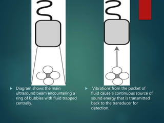  Diagram shows the main
ultrasound beam encountering a
ring of bubbles with fluid trapped
centrally.
 Vibrations from the pocket of
fluid cause a continuous source of
sound energy that is transmitted
back to the transducer for
detection.
 