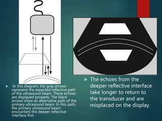  In this diagram, the gray arrows
represent the expected reflective path
of the ultrasound beam. These echoes
are displayed properly. The black
arrows show an alternative path of the
primary ultrasound beam. In this path,
the primary ultrasound beam
encounters the deeper reflective
interface first
 The echoes from the
deeper reflective interface
take longer to return to
the transducer and are
misplaced on the display.
 