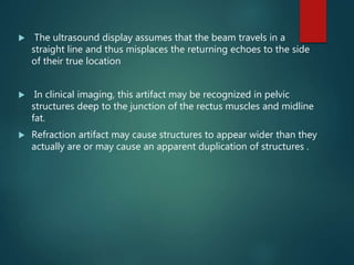  The ultrasound display assumes that the beam travels in a
straight line and thus misplaces the returning echoes to the side
of their true location
 In clinical imaging, this artifact may be recognized in pelvic
structures deep to the junction of the rectus muscles and midline
fat.
 Refraction artifact may cause structures to appear wider than they
actually are or may cause an apparent duplication of structures .
 