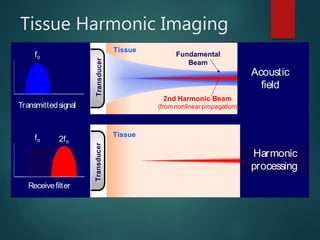 Tissue Harmonic Imaging
Conventional
processing
Acoustic
field
Transducer
Tissue
Fundamental
Beam
2nd Harmonic Beam
(from nonlinearpropagation)Transmittedsignal
fo
2fo
Harmonic
processing
fo
Transducer
Tissue
Receivefilter
 