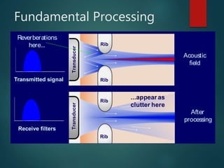 Fundamental Processing
Acoustic
field
After
processing
Reverberations
here...
Transducer
Rib
Rib
Transducer
Rib
Rib
...appear as
clutter here
Receive filters
Transmitted signal
 